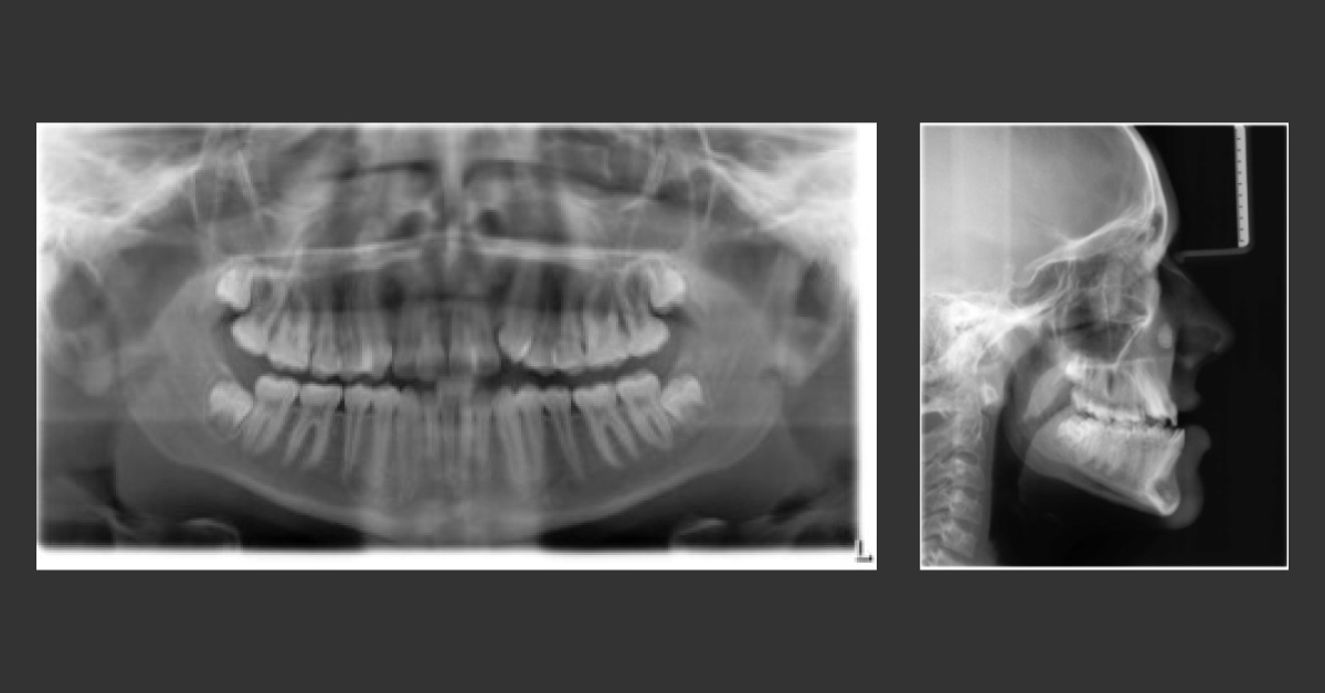 Can you Diagnose this Young Boy?