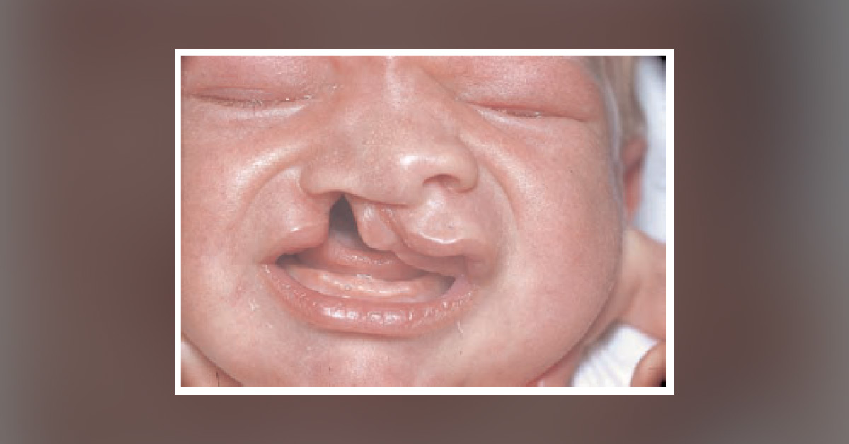 How Would You Manage This Patient?