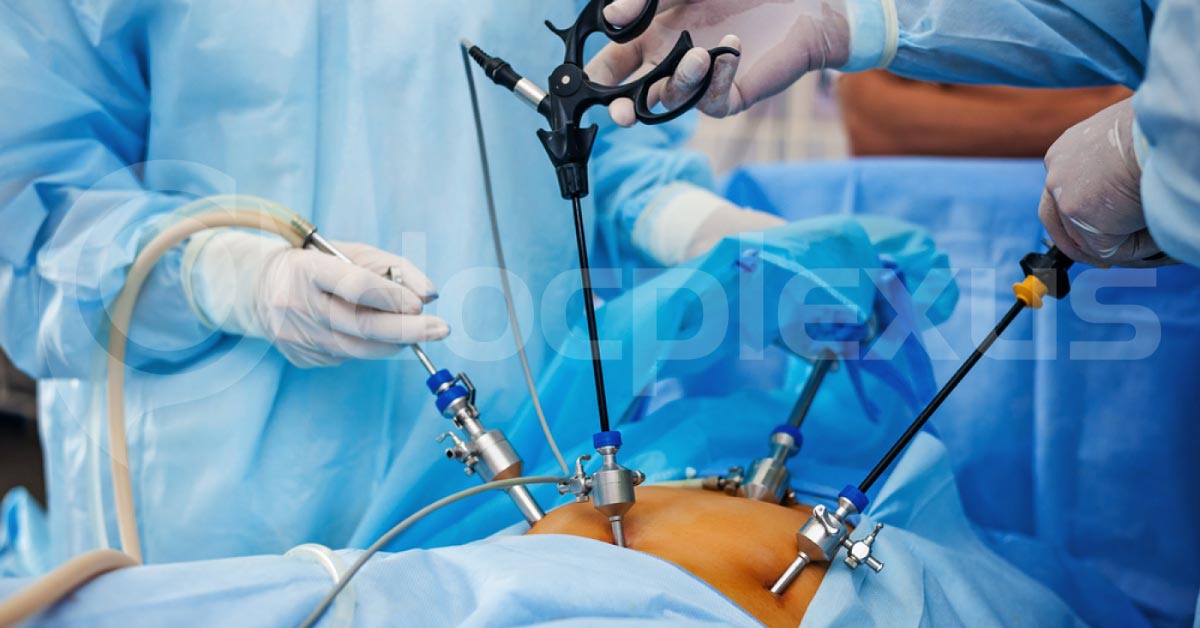 Anti Diabetic surgery  and Selection  Of Surgery- Tailoring to the needs of the patients