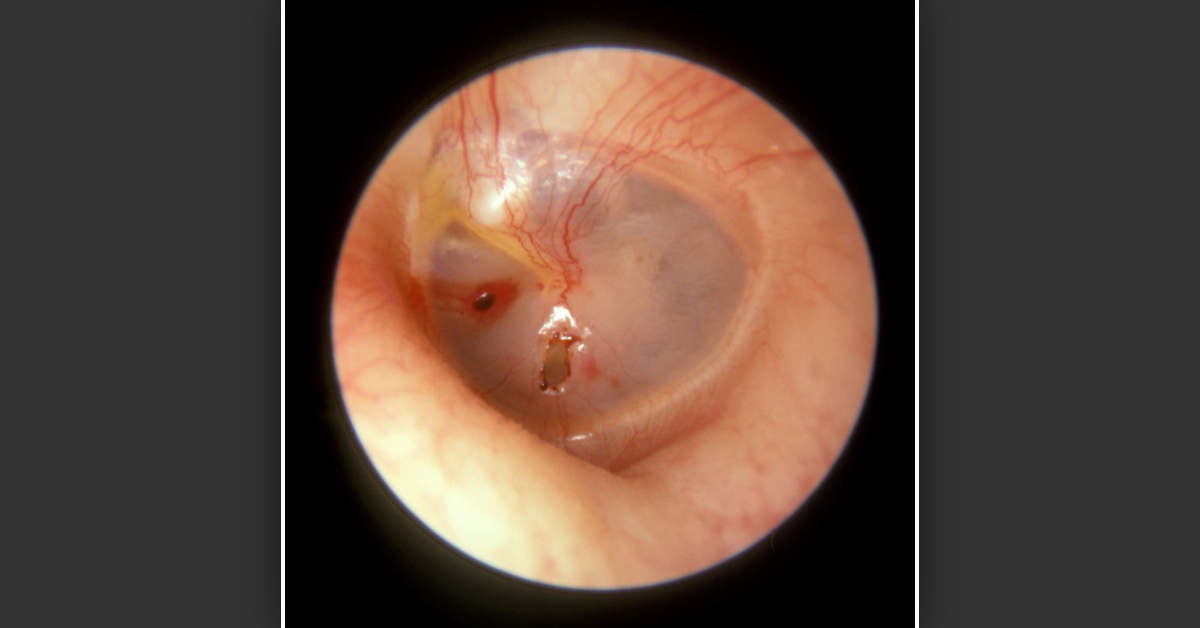 Identify the Surgery