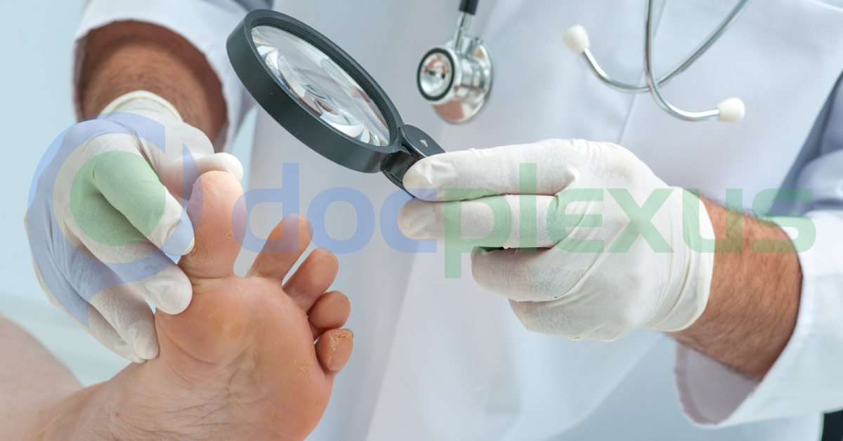 A Case of Rash and Marked Edema