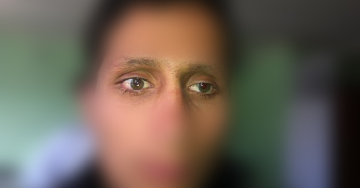 Brief Scenario On Tolosa Hunt Syndrome