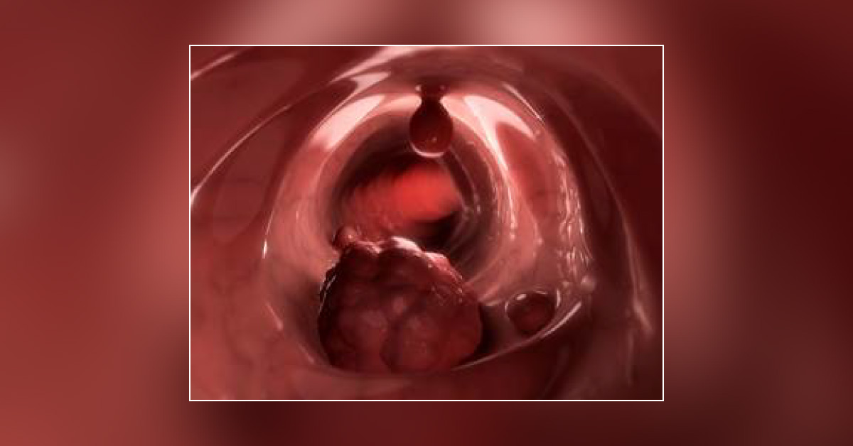 How Would You Manage This Case?