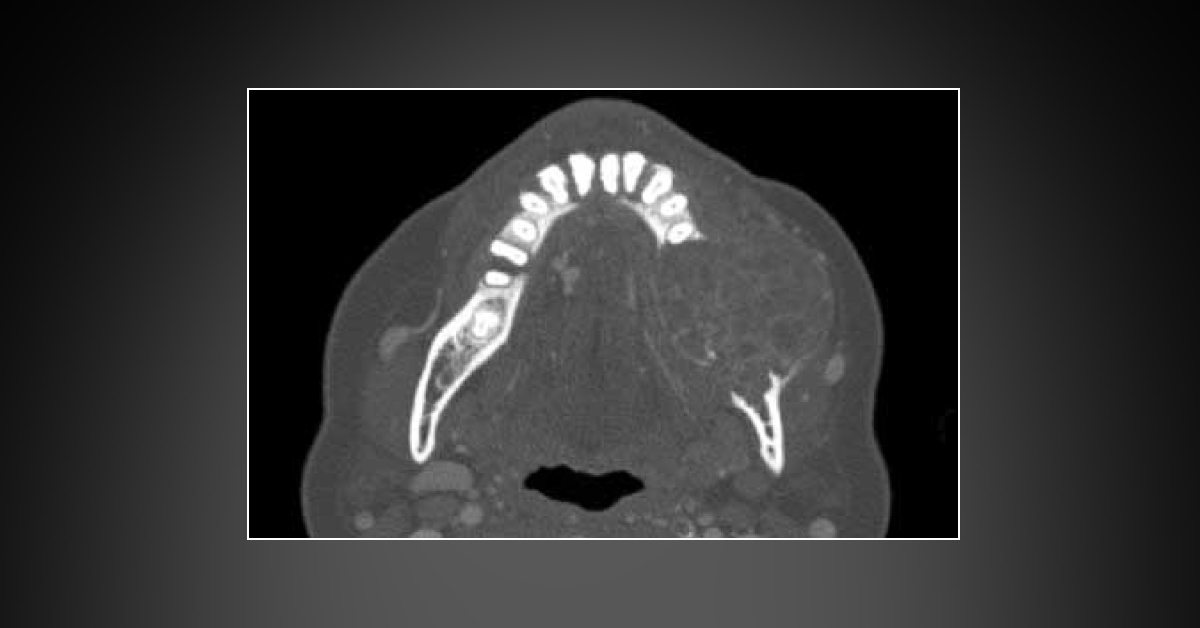 What is Your Diagnosis?