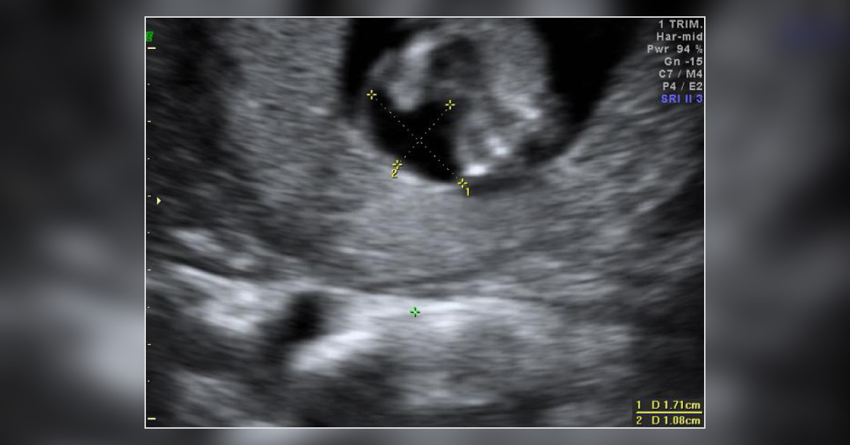 Image Based Diagnosis