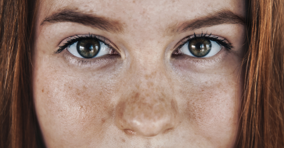 Brief Review On Laurence-Moon With Bardet-Biedl Syndrome