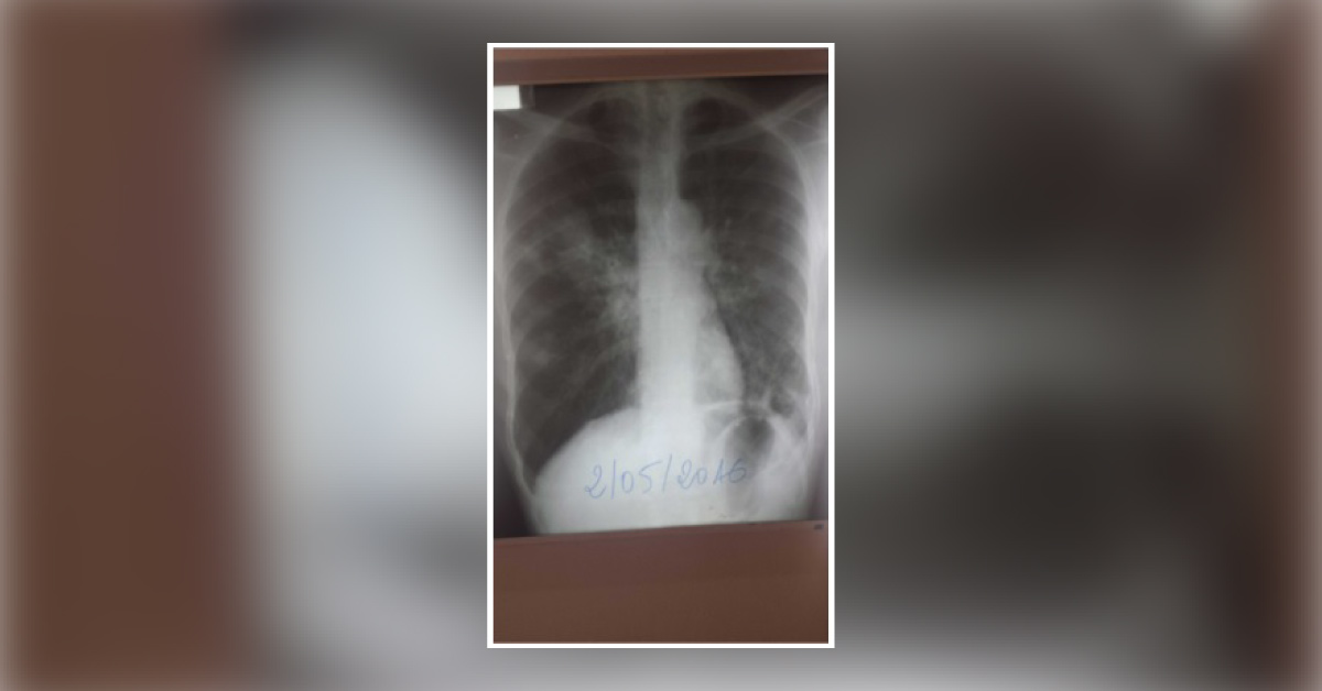 Can You Diagnose This Condition?