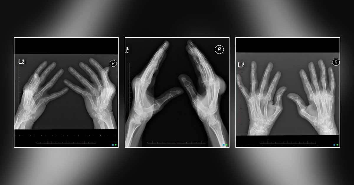 What Is Your Diagnosis?