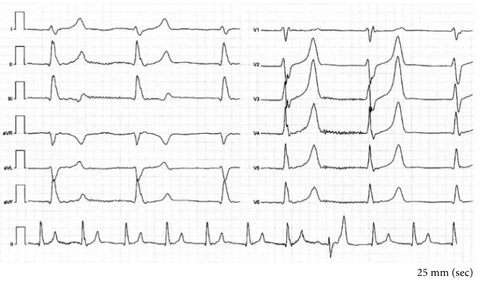 Habitual Drinker With Impaired Consciousness: What’s Your Diagnosis?