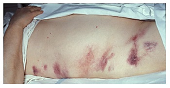 Diagnose This Case!