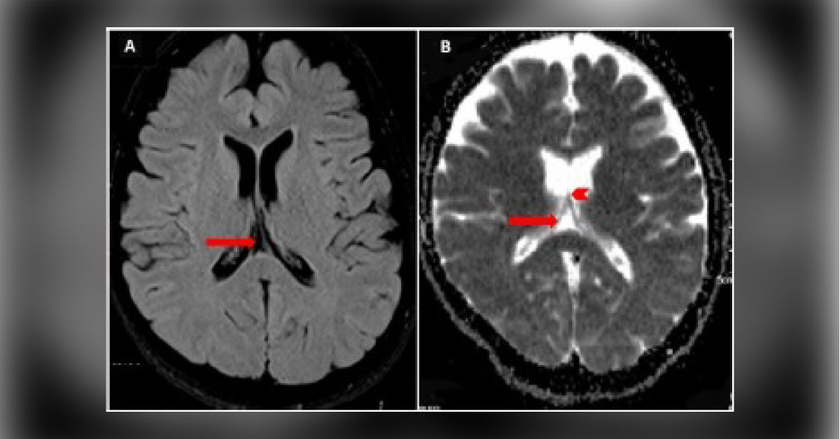 Guess the MRI