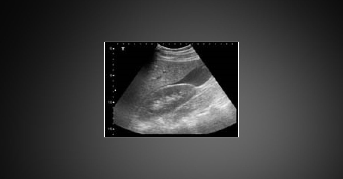 What Does This Ultrasound Scan Reflect?
