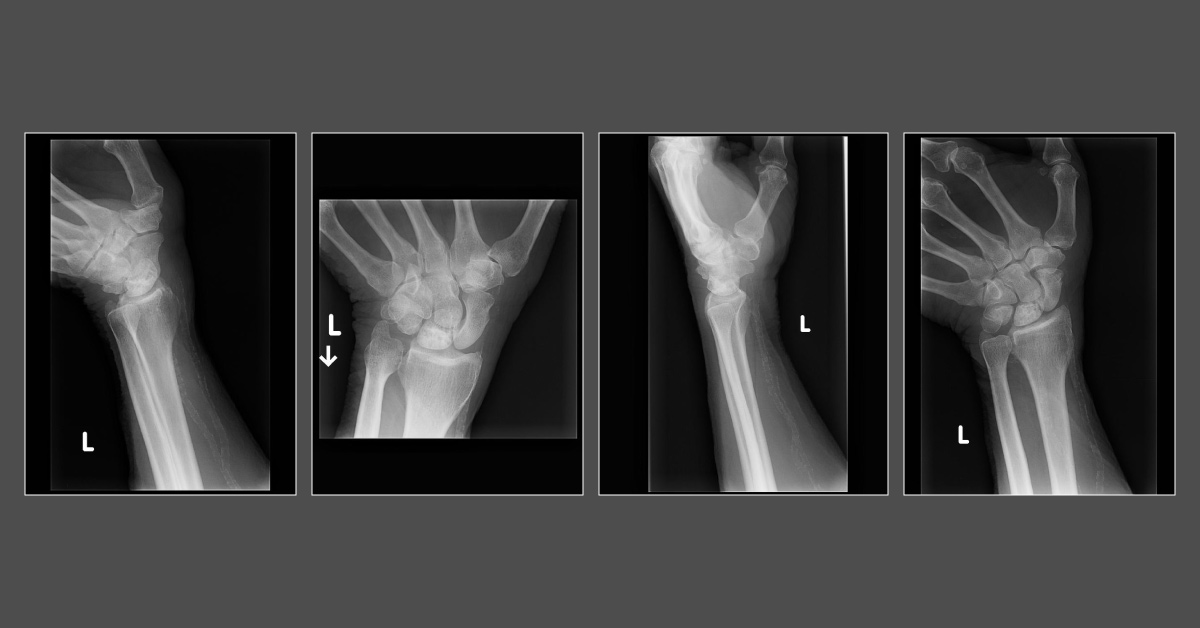 An Old Woman With Wrist Pain
