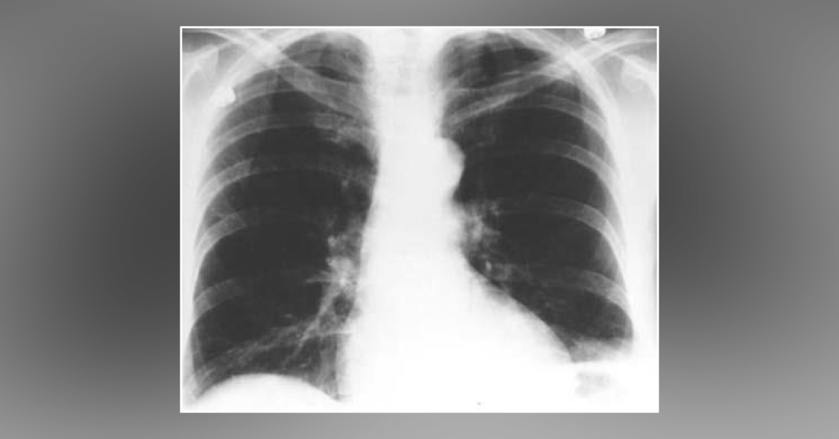 How Will You Treat This Patient?