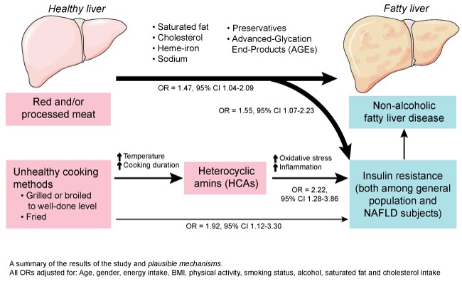 High Consumption Of Red And Processed Meat Linked To Non-Alcoholic Fatty Liver Disease And Insulin Resistance