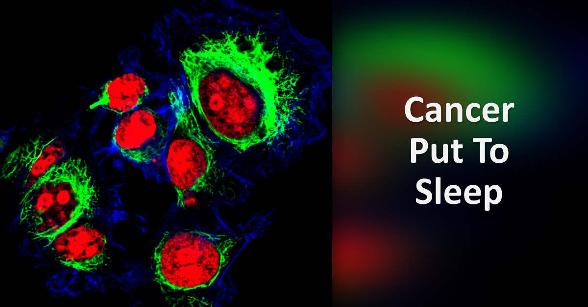 New Anti-Cancer Drug: Cancer Cells Put To Permanent Sleep