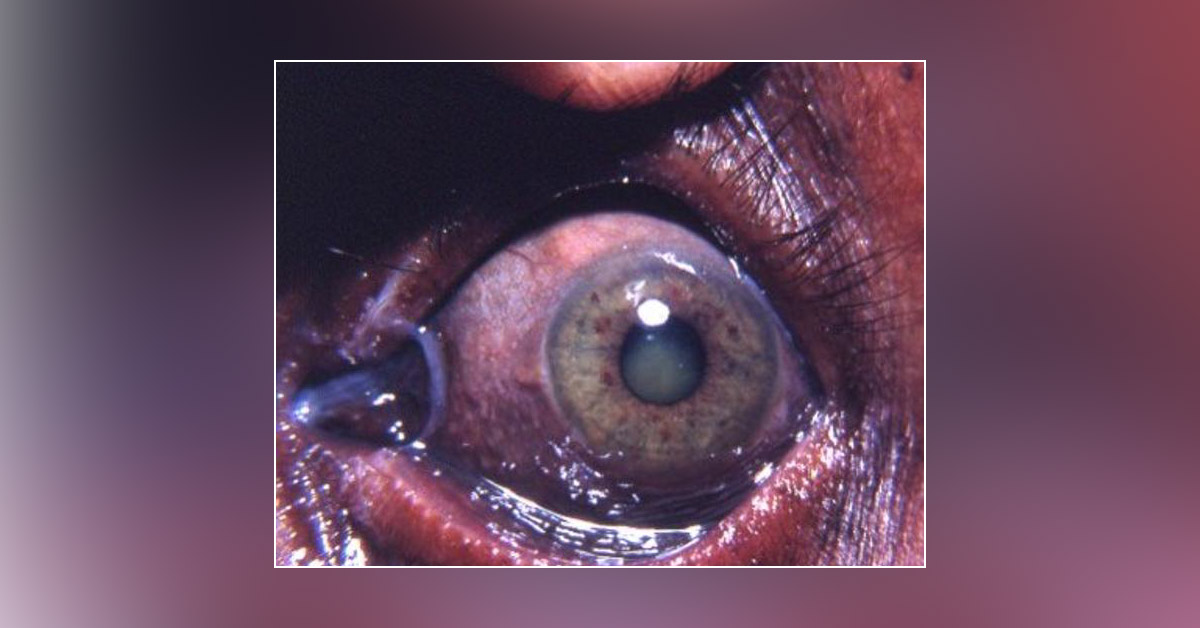 Spot The Diagnosis