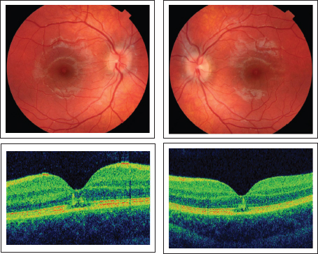 Spot The Ophthalmologic Condition