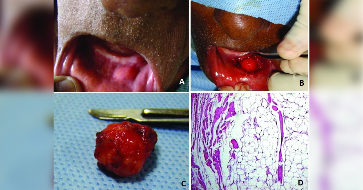 What Is Your Diagnosis?