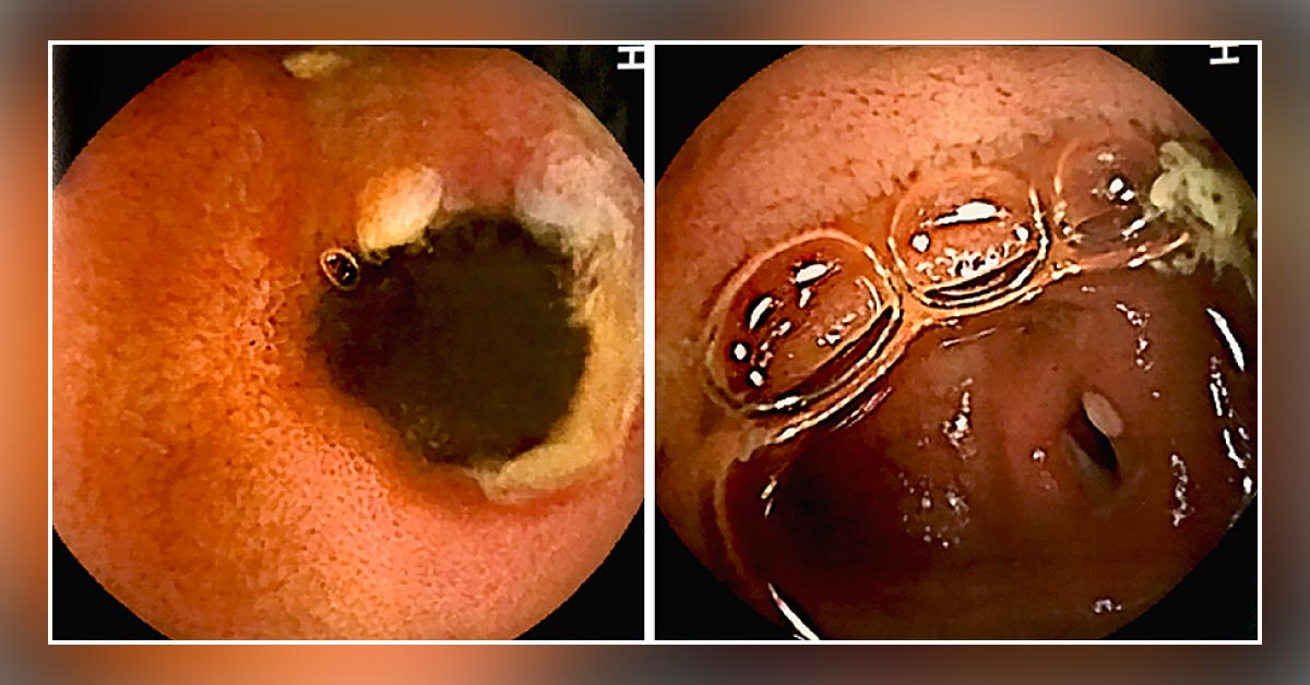 Identify the Cause of Abdominal Pain in This Woman