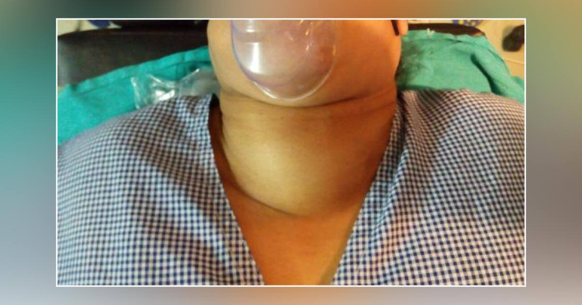 Manage This Case Of Nodular Goitre