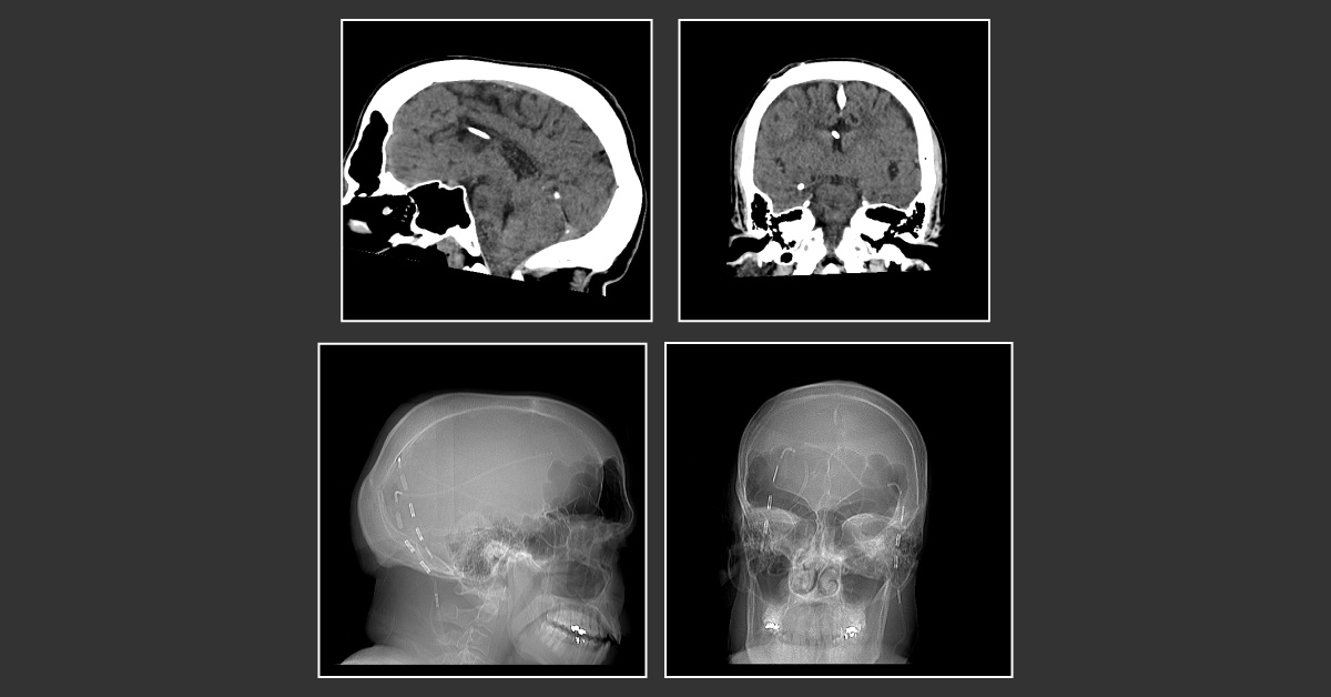 Solve This Neurology Case?