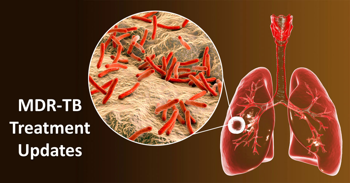 WHO Revises Multi-Drug Resistant TB Treatment
