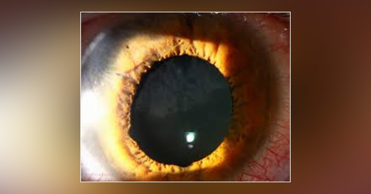 Diagnose The Ophthalmic Condition