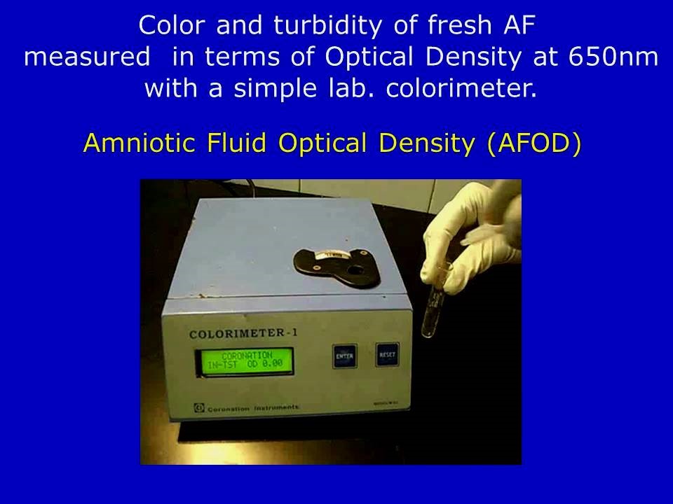 Clinical Applications Of Amniotic Fluid Optical Density (AFOD) In Obstetric Practice (Part- III)
