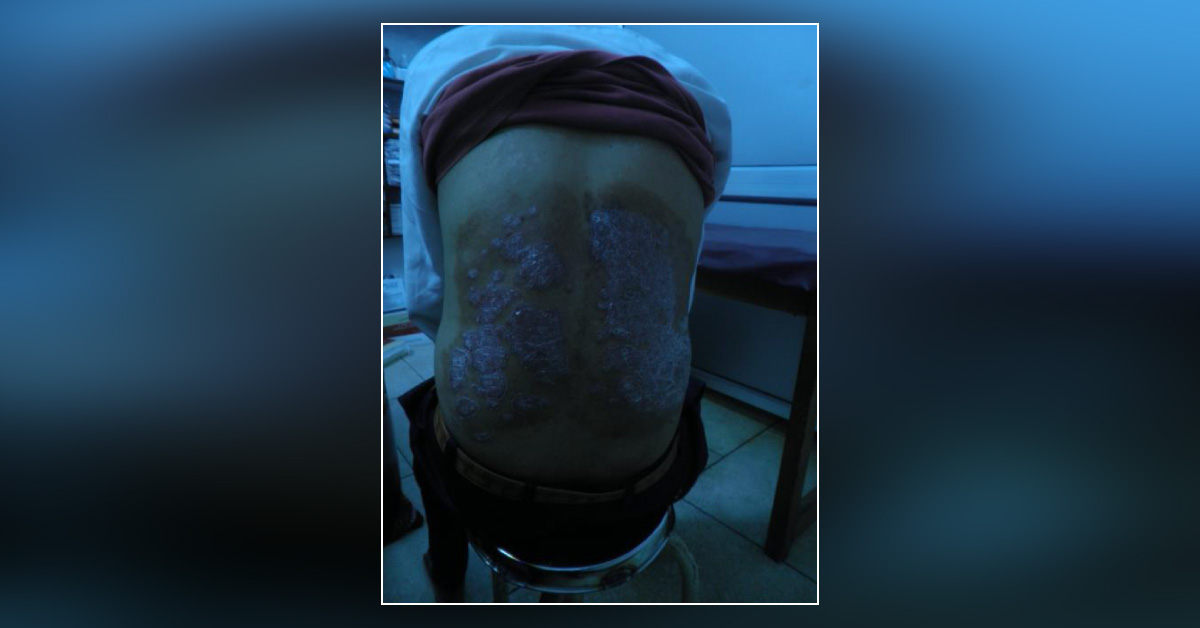 Diagnose This Skin Condition