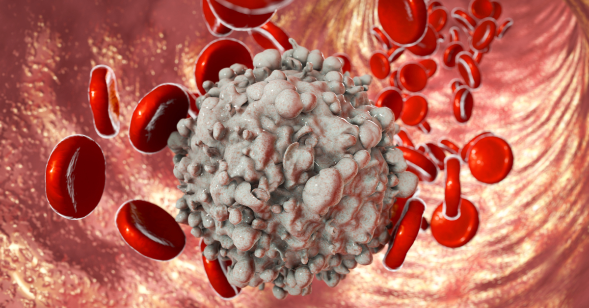 Leukaemia: Frequently Asked Questions