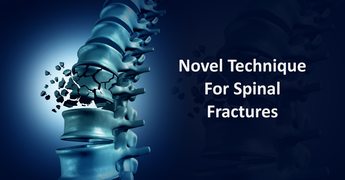 Magnetic Kyphoplasty: A Novel Drug Delivery System For Spinal Fractures