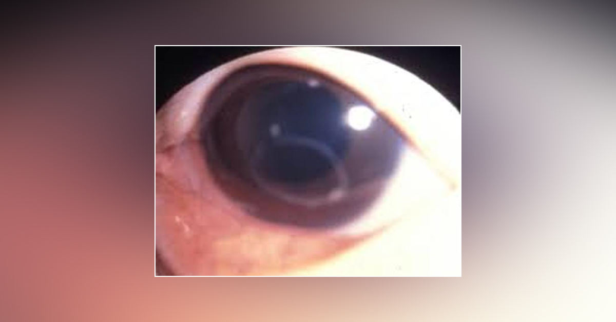 Spot The Diagnosis