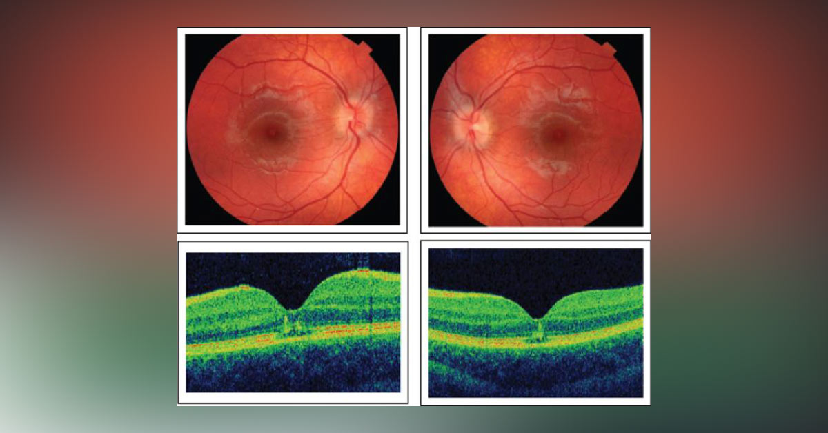 Spot The Diagnosis