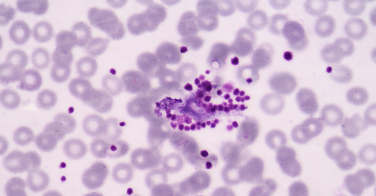 Thrombocytopenia And Its Management: Frequently Asked Questions