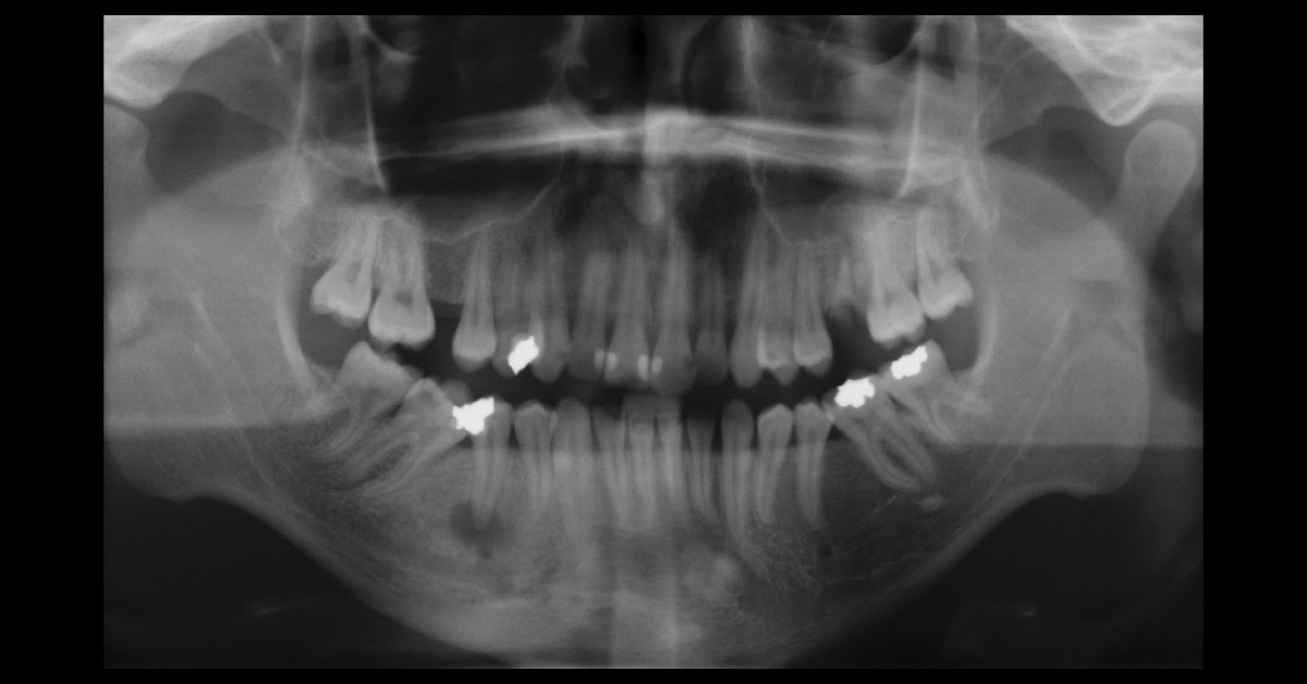 Diagnose This Dental Case?