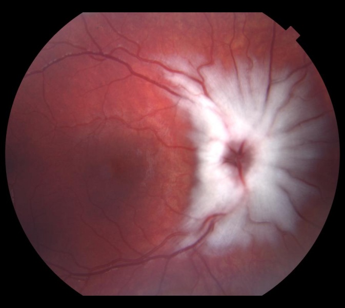 What Are Congenital Anomalies Of This Condition?
