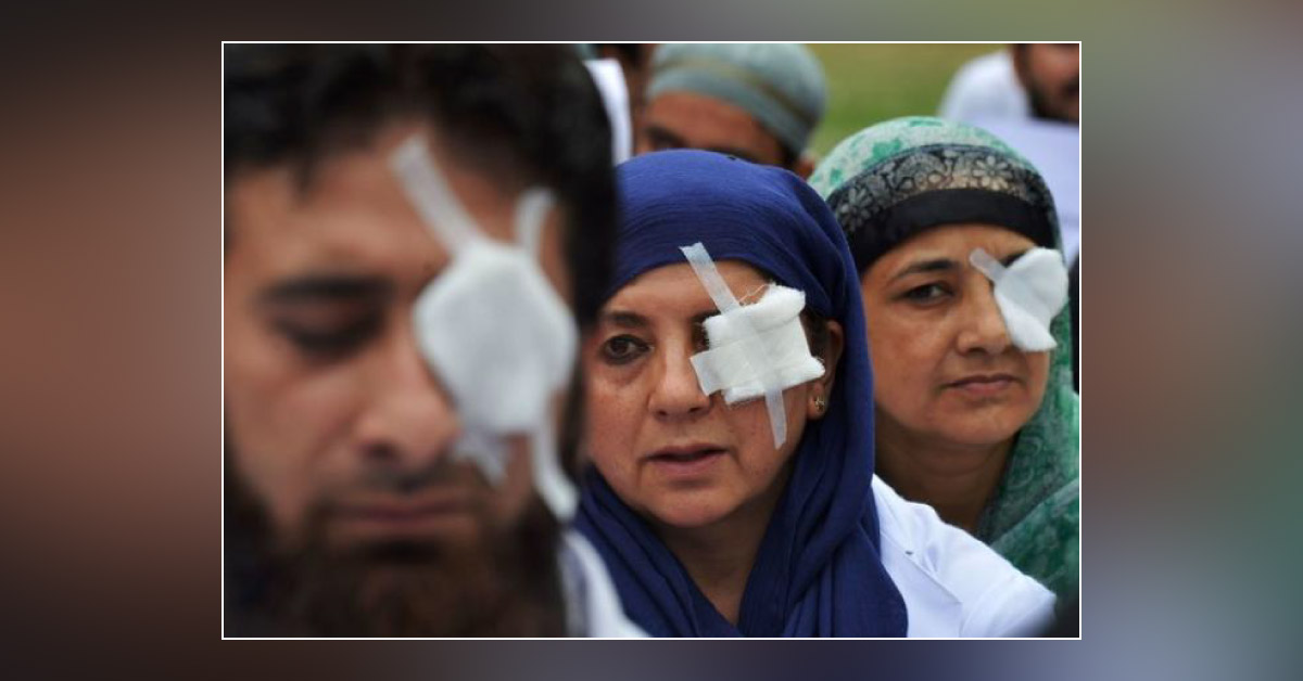 Brief Review On Pellet Hit Ocular Injuries