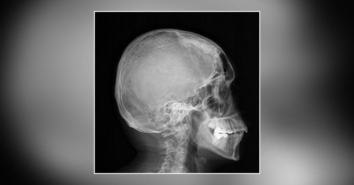 What Is Evident From The X-Ray?