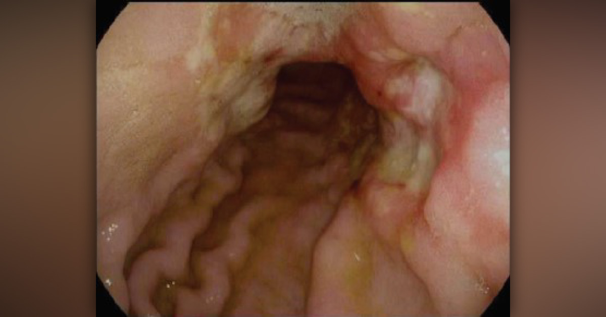 How Will You Manage This Patient?