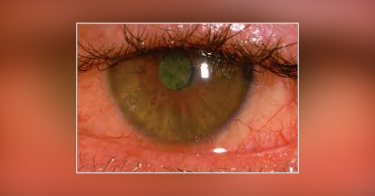 Spot The Diagnosis