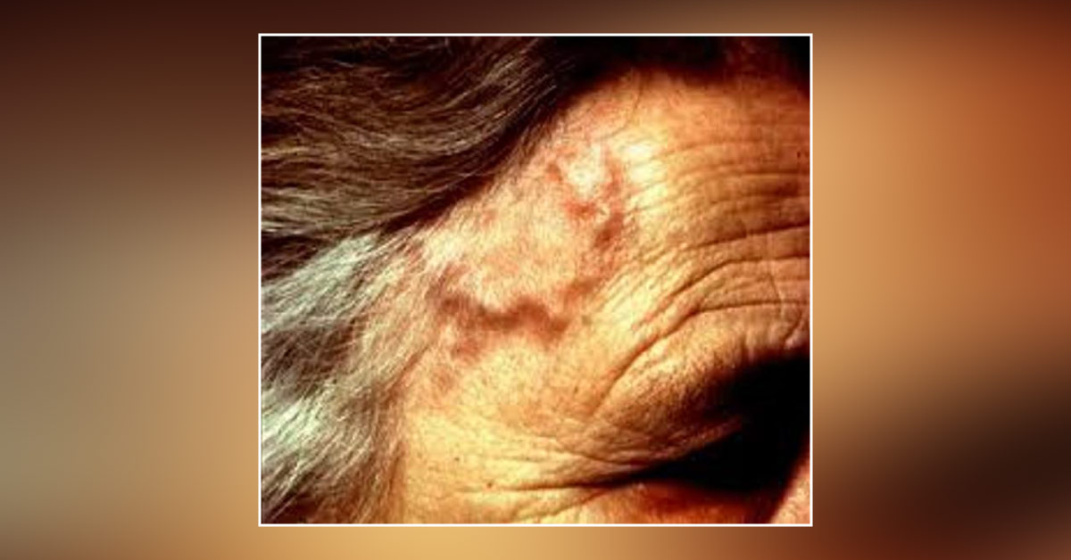 Spot The Diagnosis