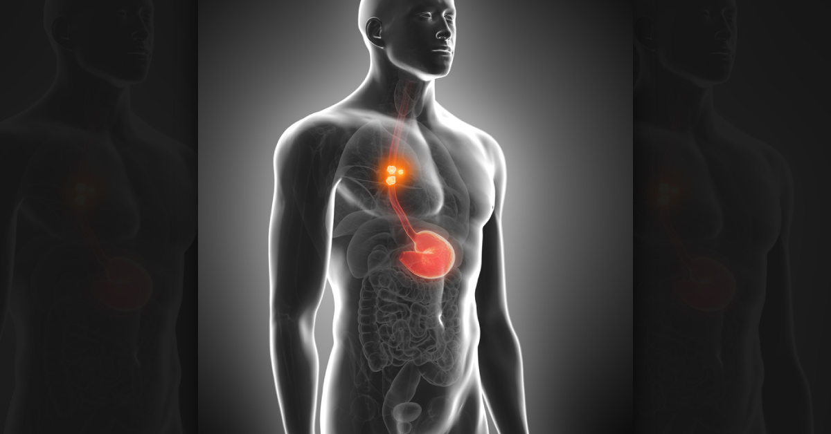 Diagnose A Case Of Spontaneous Breathing In A Chronic Alcoholic Patient