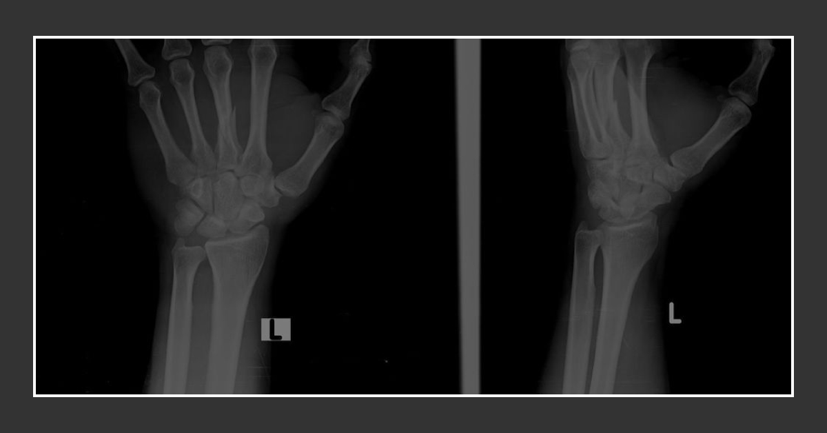 What Does The X-Ray Reveal?