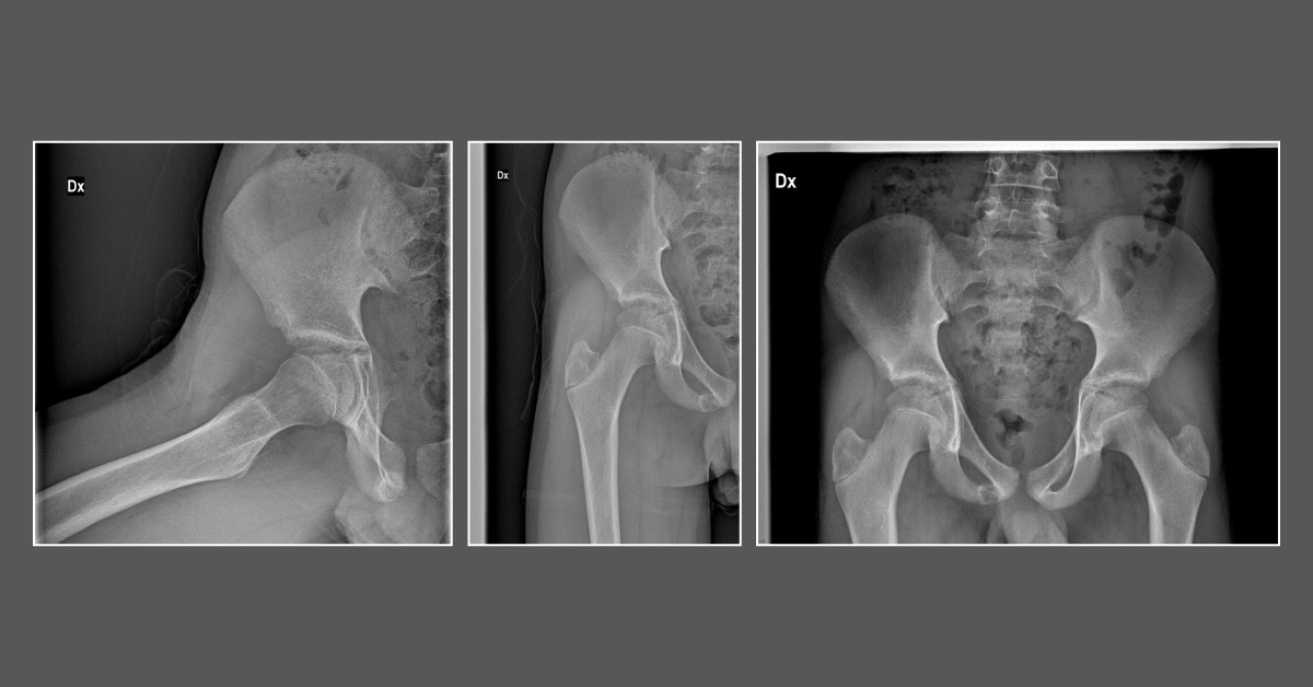 Child With Pain In Groin