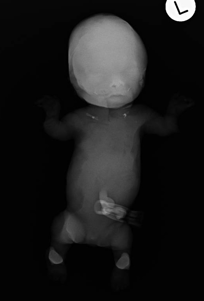 Can You Diagnose This Case?