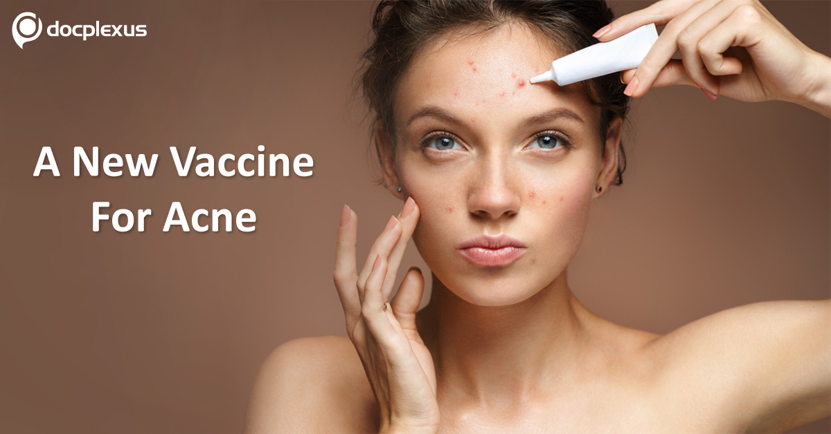 New Vaccine Can Help In Curing Acne Problems