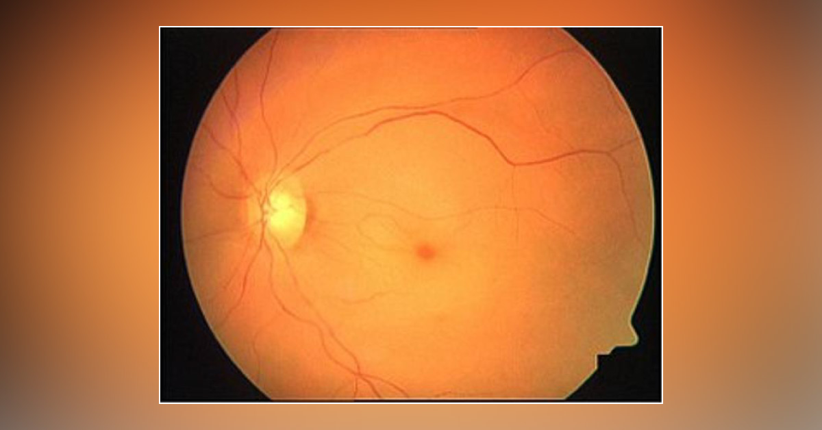 Spot The Diagnosis