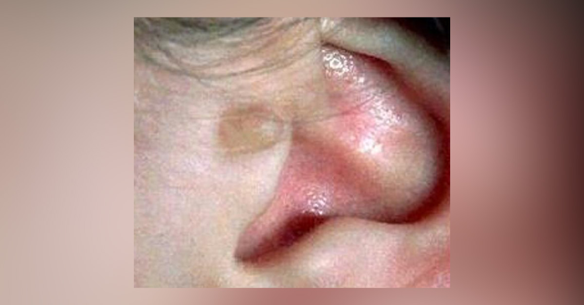 References Associated With Goldenhar Syndrome