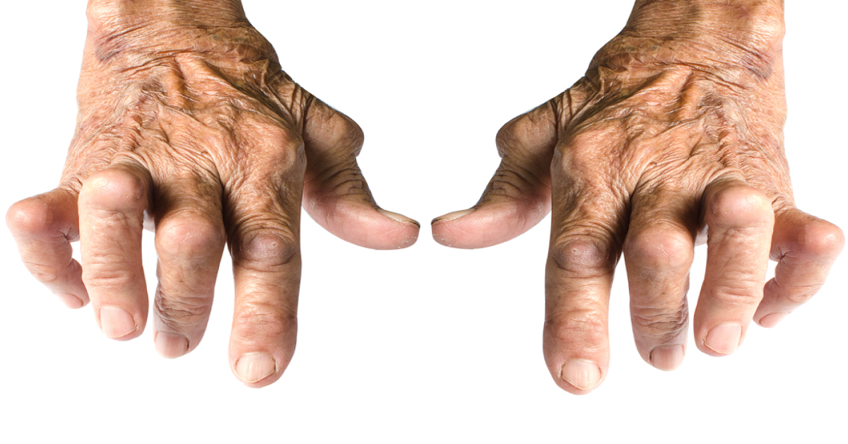 Vitamin D And Minerals That Help Rheumatoid Arthritis